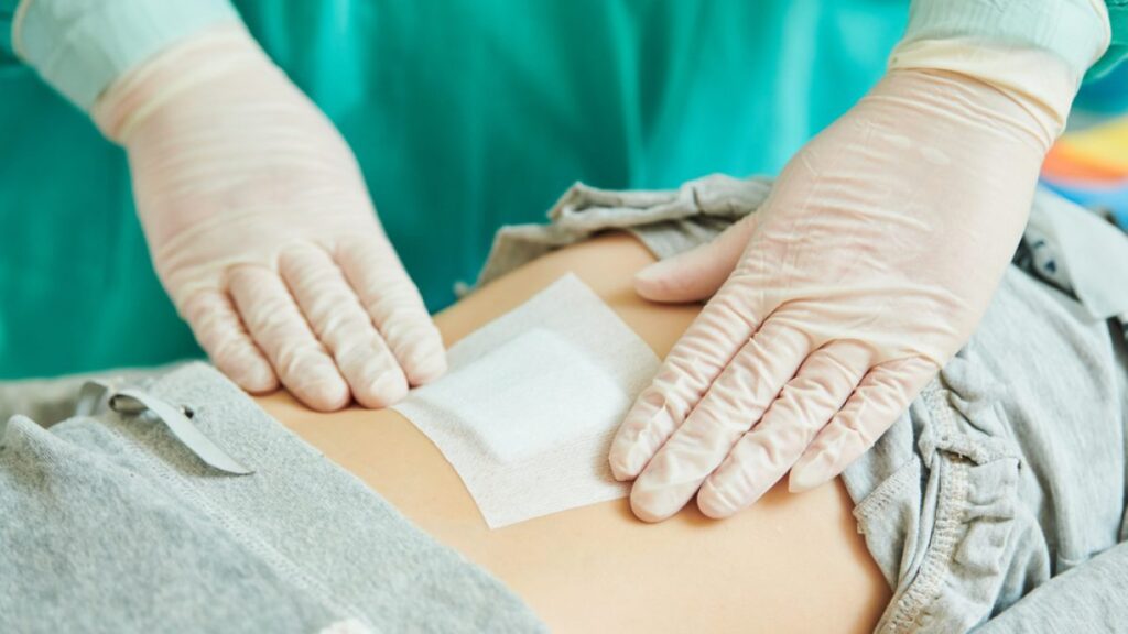 Гемостатичні матеріали в Med-Zakaz: види, механізм дії та правила вибору